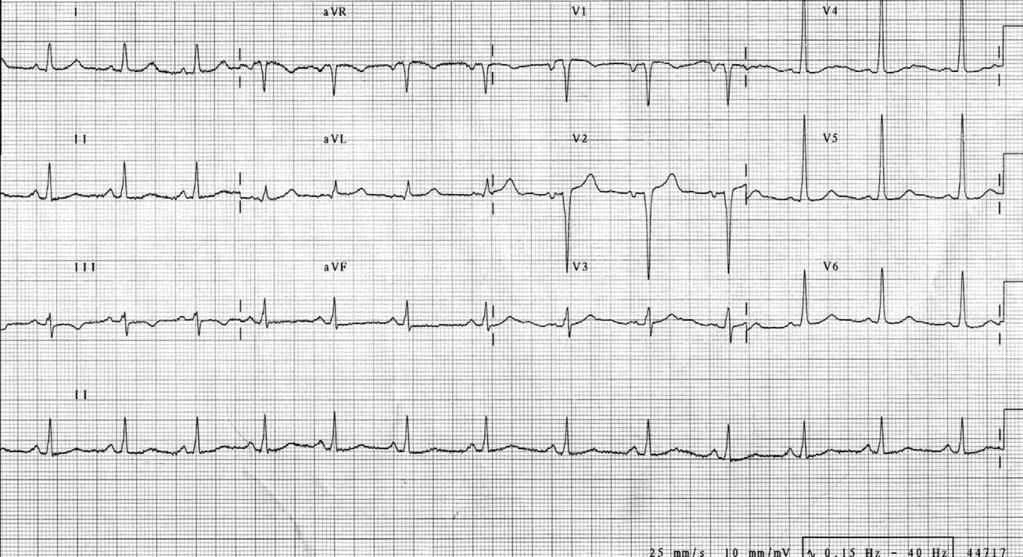 Reversal of cardiac abnormalities in a young man 389