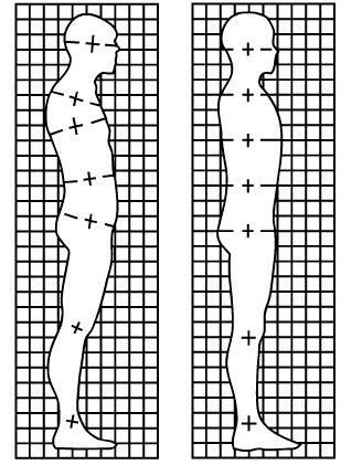 Posture Grid The use of a posture grid can make the task of performing a postural analysis a lot more effective and efficient.