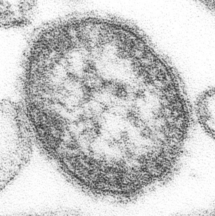 MEASLES: THE VIRUS AKA: Rubeola, Hard measles, Red measles Measles is caused by a singlestranded, enveloped RNA virus with 1 serotype.