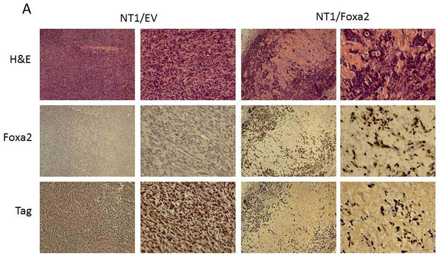 Figure 2A. Histology of control NT1 and NT1/Foxa2 tumors in intact mice. NT1/Foxa2 tumors are smaller and have relative less aggressive histology.