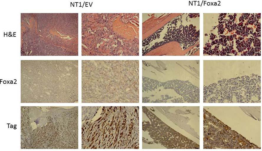 Right: TRAP staining performed on sections derived from tibias bearing NT1/EV (upper panels) and NT1/Foxa2 (lower panels) tumors.
