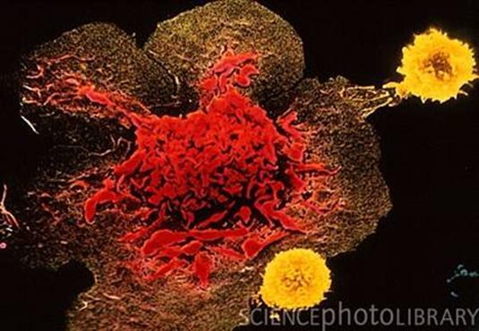 Immunotherapy for Cancer: 1970-1980 - Rosenberg et al 2.