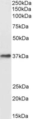 Images Western Blot: DARC Antibody [NB100-2421] - DARC (0.3ug/ml) staining of Human Liver lysate (35ug protein in RIPA buffer).
