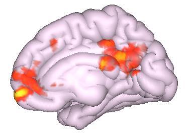 Resting state functional connectivity of