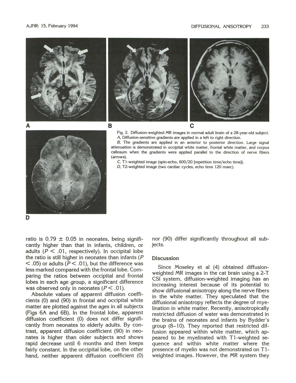 AJNR: 15, February 1994 DIFFUSIONAL ANISOTROPY 233 A B c Fig. 2. Diffusion-weighted MR images in normal adult brain of a 28-year-old subject.