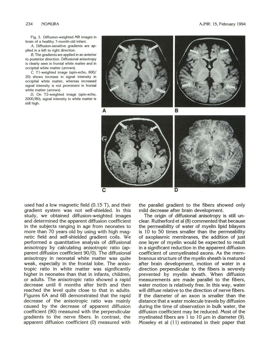234 NOMURA AJNR: 15, February 1994 Fig. 3. Diffusion-weighted MR images in brain of a healthy 7-month-old infant. A, Diffusion-sensitive gradients are applied in a left to right direction.