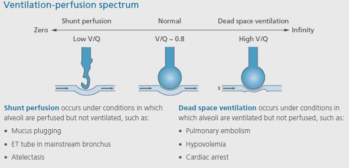 Anatomical dead space can occur due to changes in gravity (i.e. posture positions: sitting, standing, lying); it will affect both ventilation (V) and perfusion (Q).