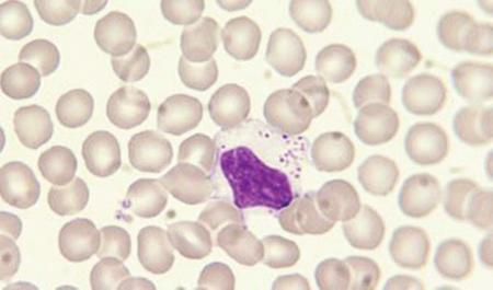 These categories are small lymphocyte (Fig. 1.5), large lymphocyte (Fig. 1.9) and large granular lymphocyte (Fig. 1.10). Small lymphocytes are most numerous.