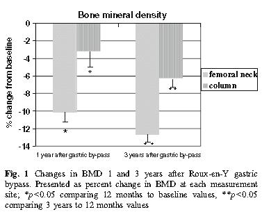 Bone mineral density RYGB is not detrimental for bone Menopausal women and those with greater lean mass are at higher
