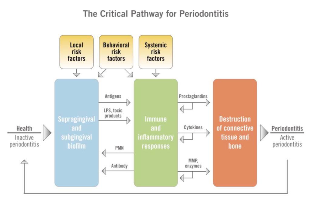 Figure. The critical pathway for periodontitis. The pathological process is initiated with the accumulation of dental plaque and maturation of the biofilm.
