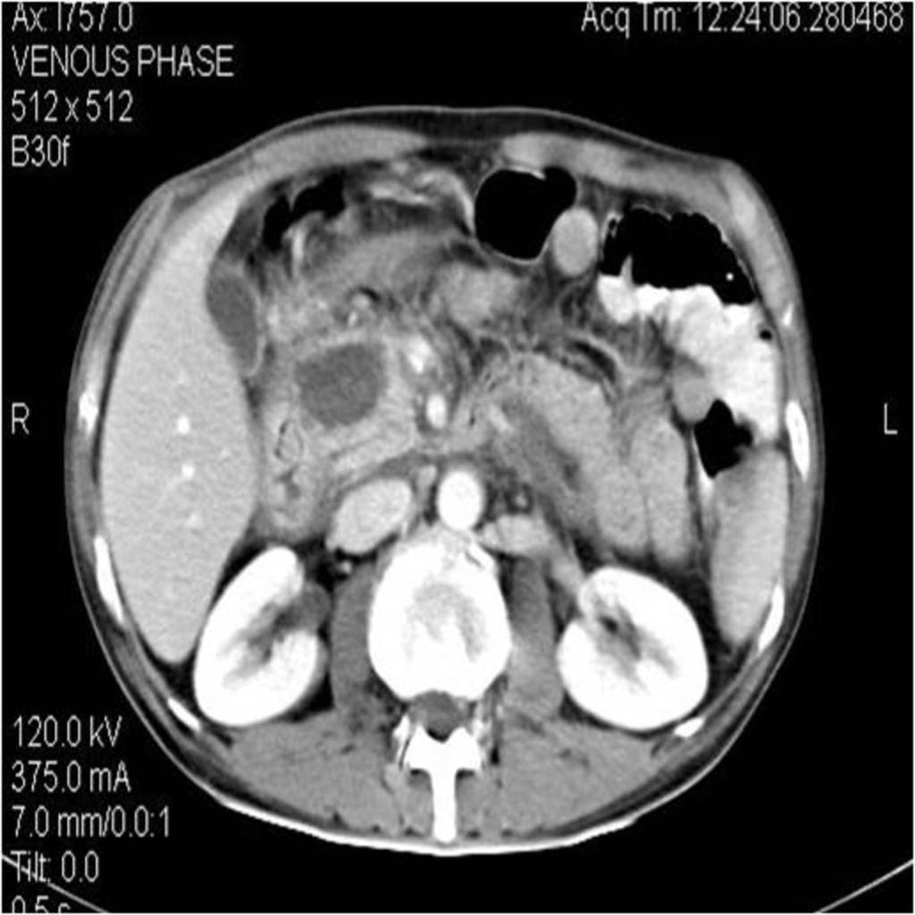 Fig. 8: Pancreatic