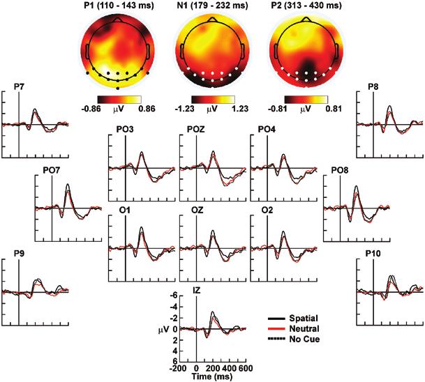prior observations of dissociable attention-related N1 responses.