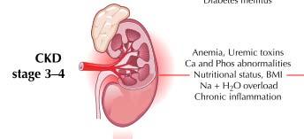 CRS type 4 Anemia, Uremic toxins Ca and P abnormalities