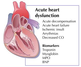 urinary obstruction Acute decompensation Acute heart failure