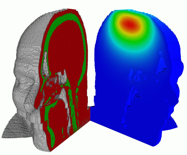 Calculate Dose Treatment Planning Use Patient-based CT geometry. Calculate dose throughout head, tumor. Change beam direction and look at differences in dose distributions.