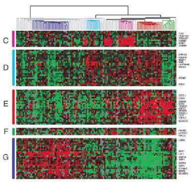 Genomics of Breast Cancer: DNA Microarray and hierarchical clustering Luminal Subtype A Luminal HER-2+ Basal Subtype B Subtype Normal Breast like