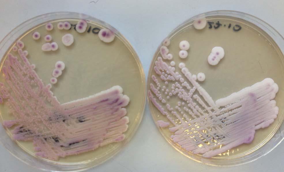 Candida colonies on