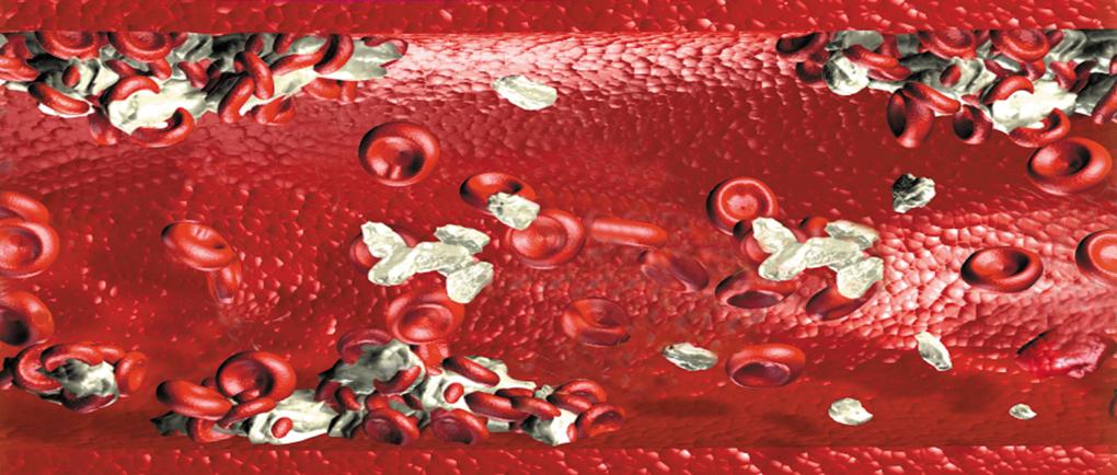 hyperreactivity (diabetic thrombocytopathy) Platelet