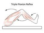extension, head turning, and slow arm lifting Clinical Exam Clinical Exam Pupils should be midposition (4 mm to 6 mm) and