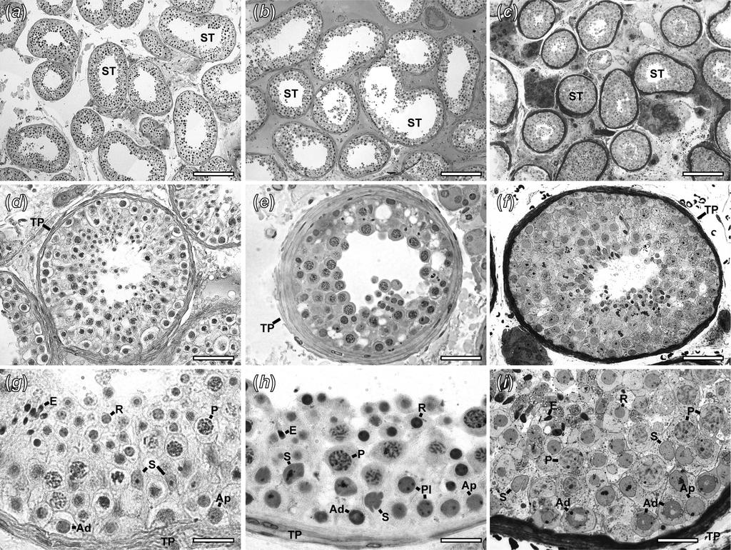 spermatogonia, preleptotene spermatocytes, pachytene spermatocytes and round spermatids - Sb1) as well as the nucleoli and nucleus of Sertoli and Leydig cells, respectively.
