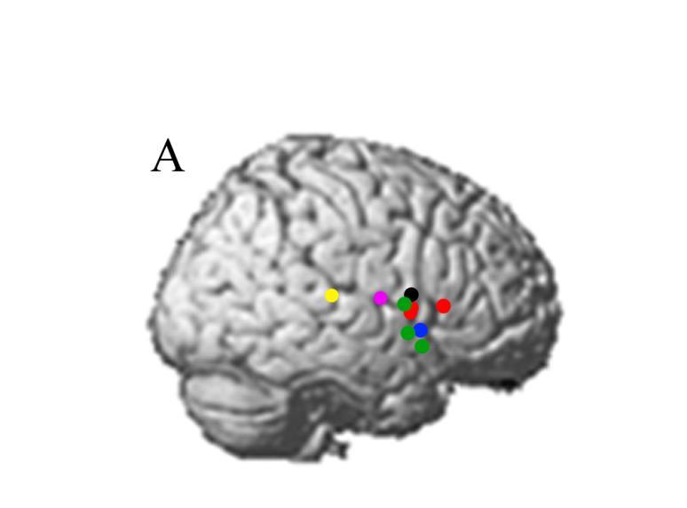 Insula and adjacent lateral frontal areas activated during