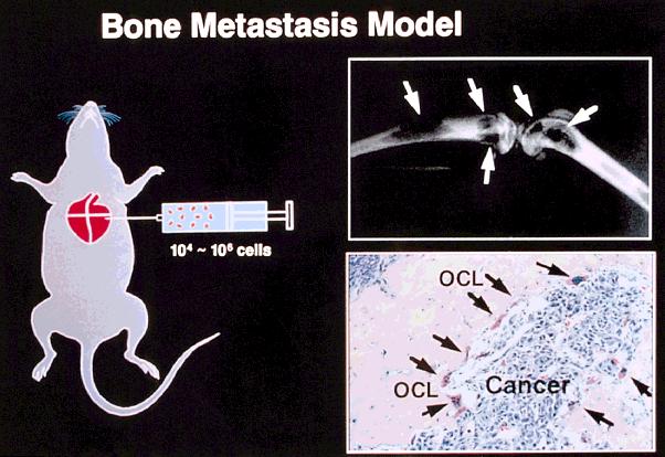 Bisphosphonate Actions on Bone Metastasis/Yoneda et al. 2981 FIGURE 2. Heart injection model of bone metastasis (experimental bone metastasis model) is shown.