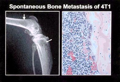 2982 CANCER Supplement June 15, 2000 / Volume 88 / Number 12 FIGURE 3. Orthotopic bone metastasis model (spontaneous bone metastasis model) is shown.