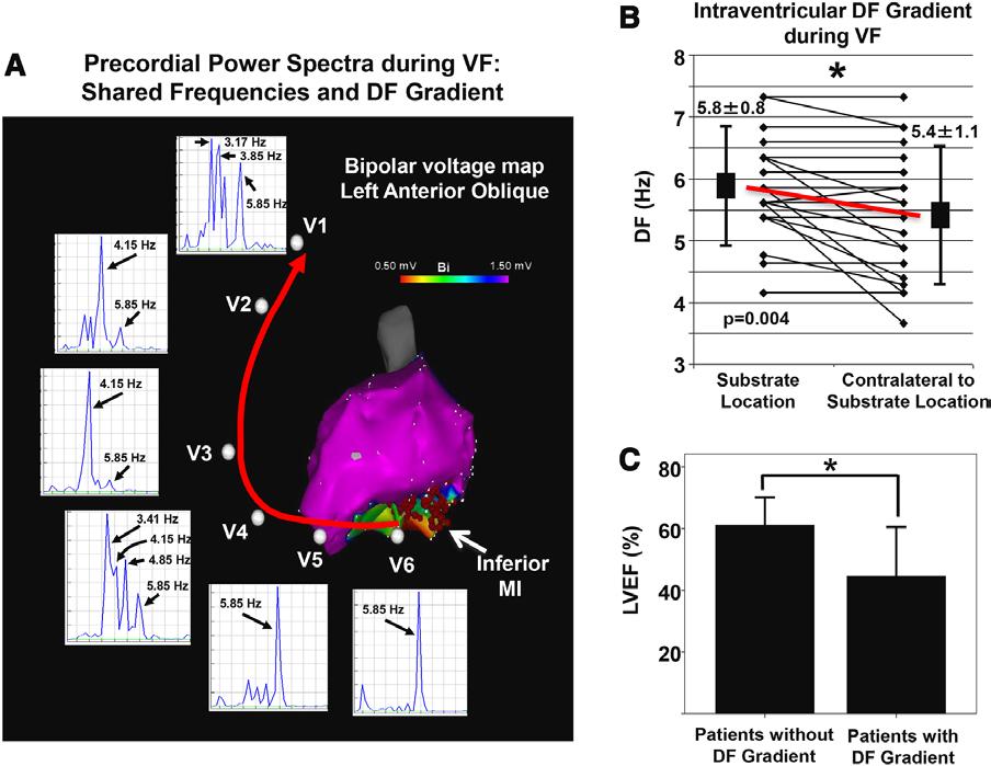 Calvo et al Frequency-Phase ECG and Substrate in Human VT/VF 1141 Figure 7. Phase sequences in ventricular fibrillation (VF) and ventricular tachycardia (VT).