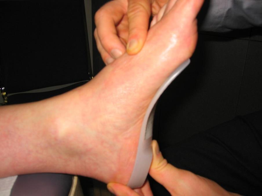 Tighter orthotic supports base of