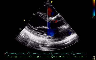 Echocardiographic assessment