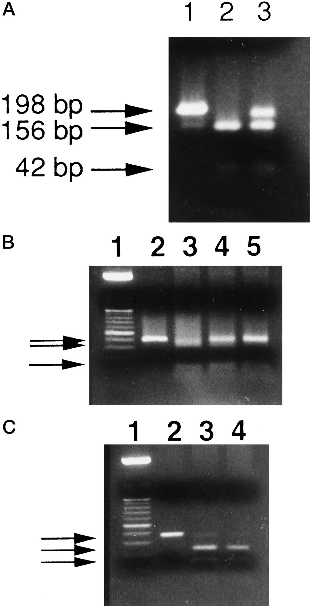 RET MUTATION IN FNAB 3381 FIG. 3. A, Restriction analysis of cdna derived PCR products of RET exon 16 after FokI digestion (3 h at 37 C).