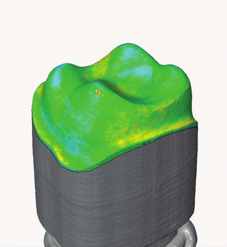 The New Leader in Dental 3D Printing.