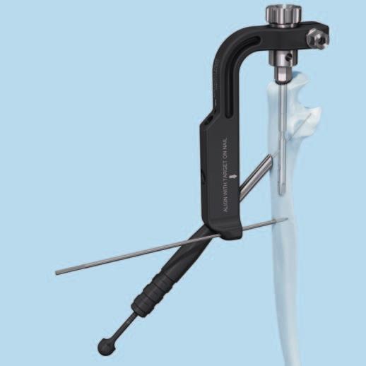 Implantation Option B: Measure for screw length with depth gauge for 2.7 mm screws Instrument 03.007.