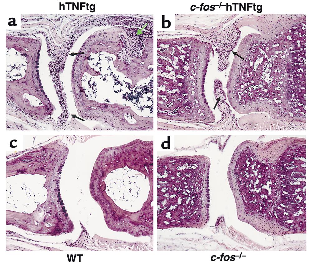 Figure 2 Severe joint inflammation is seen in htnftg and c-fos / htnftg mice, but no signs of bone erosions are found in c-fos / htnftg mice.