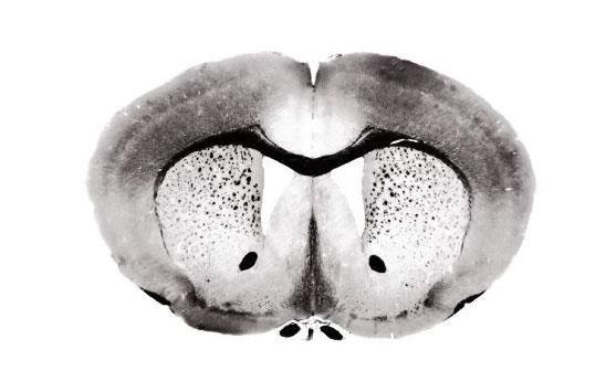 Gross anatomy of the striatum: gateway to the basal ganglia rodent Dorsomedial striatum: -Inputs predominantly from mpfc, thalamus, VTA Dorsolateral striatum: -Inputs from sensorimotor