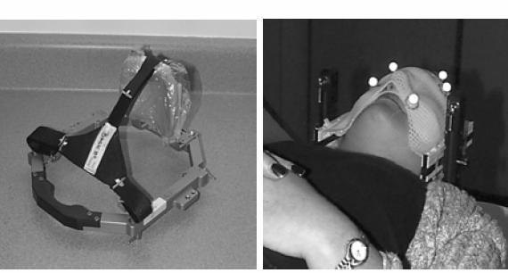 Masks for FSR immobilization Fractionated Stereotactic Radiotherapy vs.