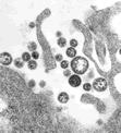 Lassa Fever Lassa fever is an acute viral illness that occurs in West Africa. The illness was discovered in 1969 when two missionary nurses died in Nigeria, West Africa.