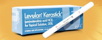 Step 1: Application of LEVULAN KERASTICK Topical Solution LEVULAN KERASTICK will be uniformly applied to your AK lesion.