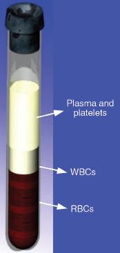 Orthobiologic Definition Platelet-Rich Plasma (PRP) Orthobiologics are biological substances that are used to help injuries to heal more quickly.