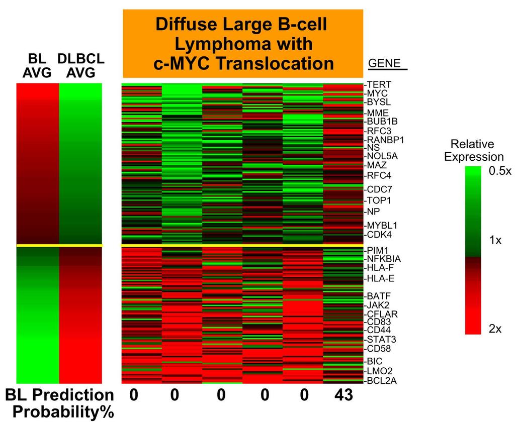 DLBCLs WITH MYC TRANSLOCATIONS SHOW A GENE EXPRESSION PROFILE OF DLBCLs From N Engl J Med, Dave SS, et al.
