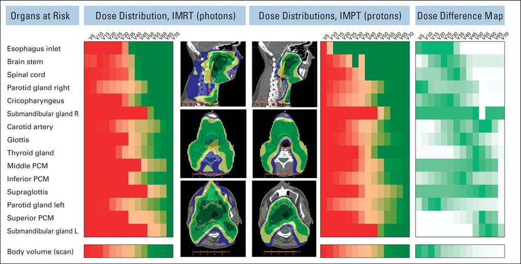 Comparison of dose distribution between IMRT