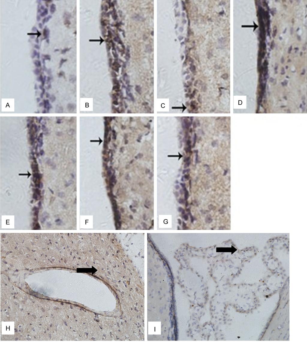 Figure 5. Immunohistochemistry of Aquaporin-4 (AQP4) expressions in ependyma, choroid plexus and blood capillary. A: Sham (S) group. B: Ischemia-reperfusion (IR) 6 h group.