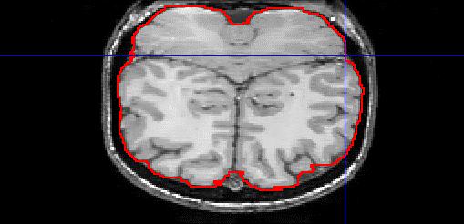 6) cerebel L : The Left-most aspect of the cerebellum. This is according to the neurological convention where Left is on the left-hand side of the screen, even if your data are not.