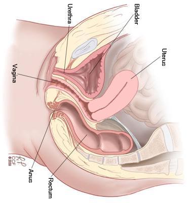! Pelvic organ prolapse Study of the histological properties Tissue collection Mid vagina and Apical vagina