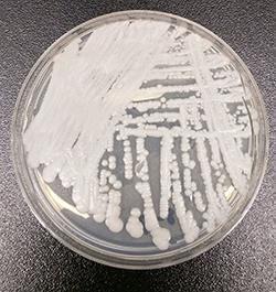 MDR Candida auris Simultaneously emerged on three continents Can colonize patient skin for months Can survive on hospital surfaces for months Associated with hospital outbreaks similar to MRSA or