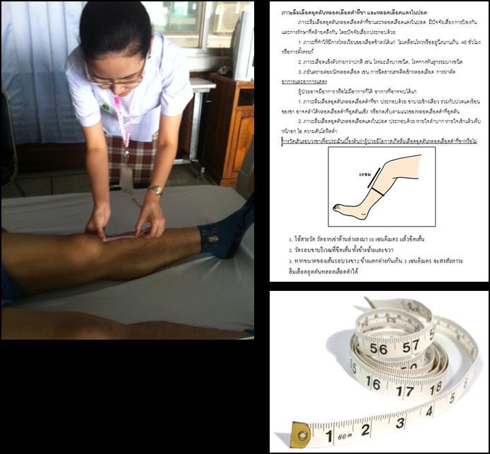Low Incidence of Symptomatic VTE Without Thromboprophylaxis after Hip and Knee Arthroplasty at Siriraj Hospital Prospective observational study n = 896/1200 Inclusion criteria: adult 18 years old who