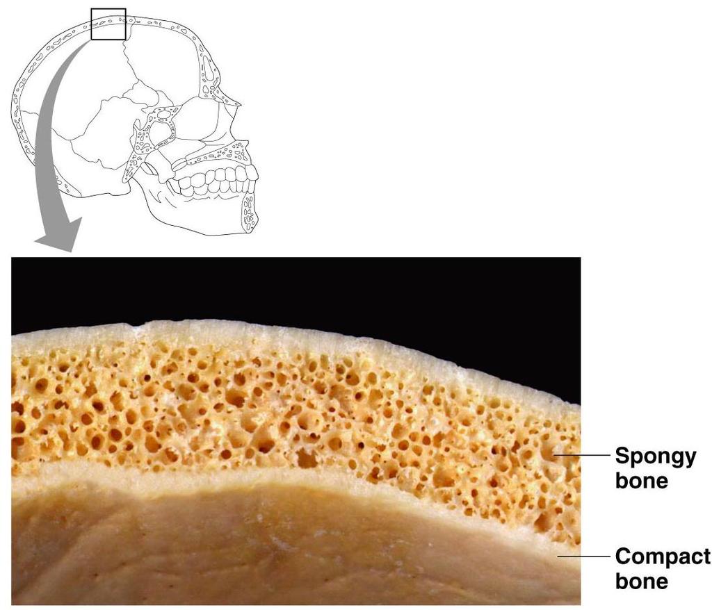 The Structure of Spongy Bone No osteons