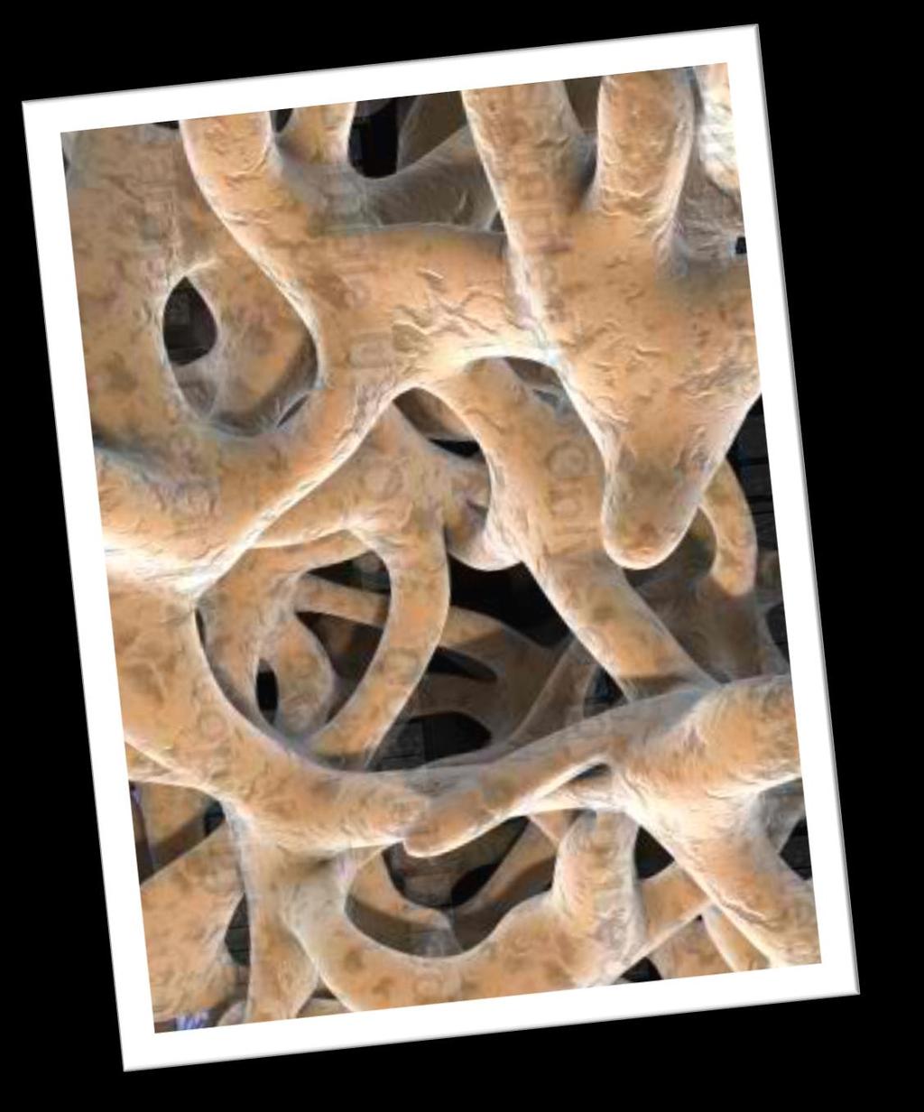 - Trabecular bone tissue (haphazard arrangement).