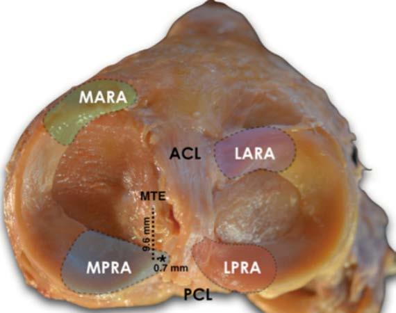 anatomy Lateral meniscus root attachment Anterior