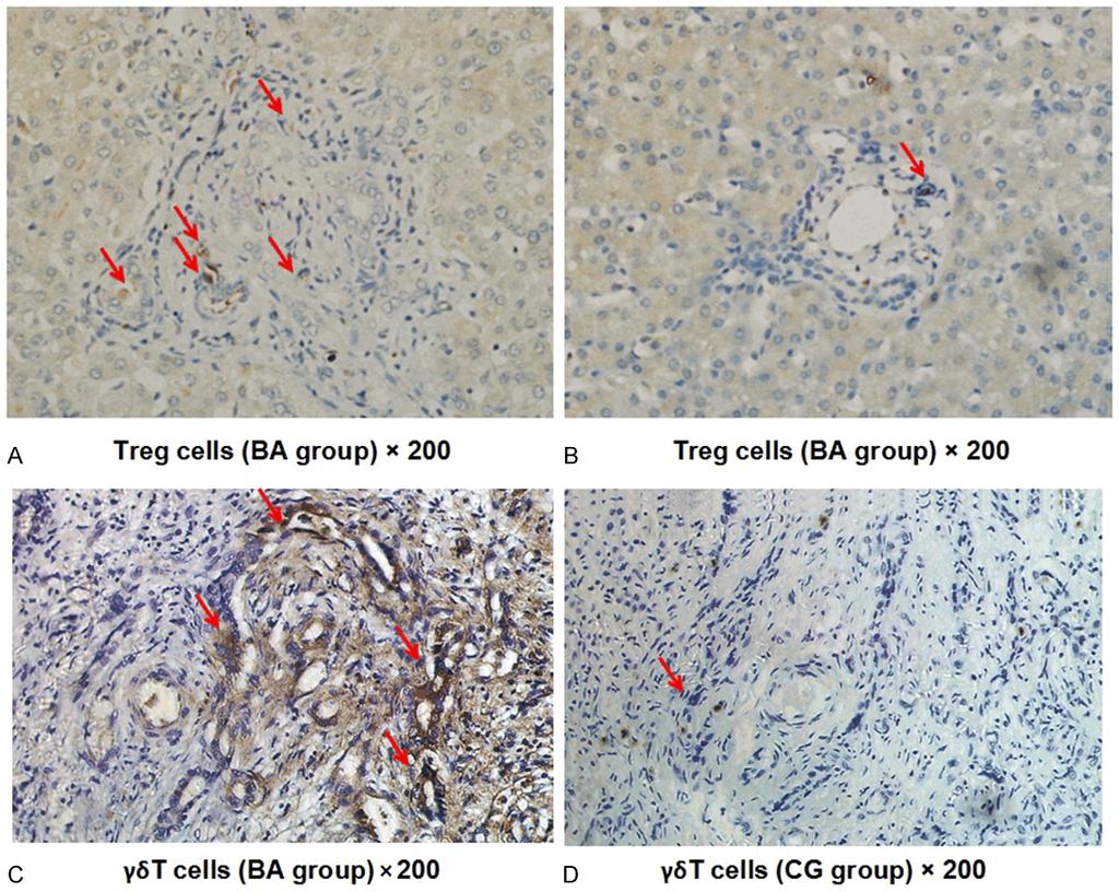 Figure 1. Distribution of liver treg and γδ T cells in BA group and CG. A, C. Section of the Periportal Bile Duct of Liver in BA Group; B, D.